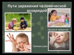 Аскаридоз у детей
